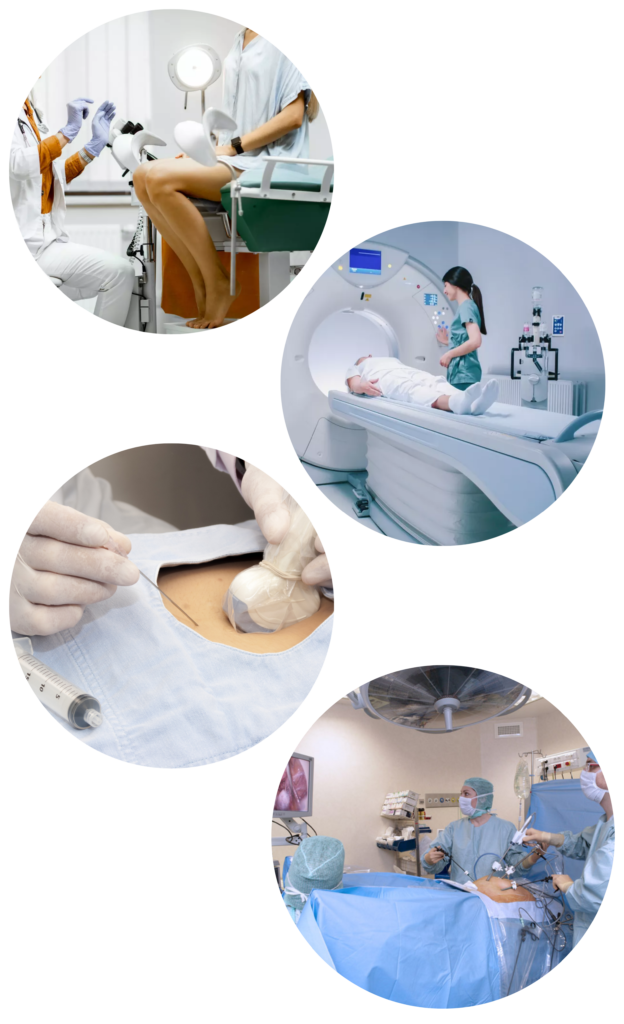 Qu'est ce que l'endométriose ? 3 diagnostic endometriose
